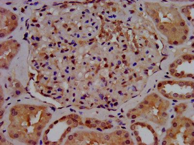 SLC7A1 Antibody