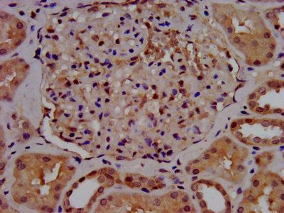 SLC7A1 antibody