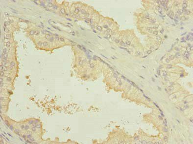 SLC7A14 Antibody