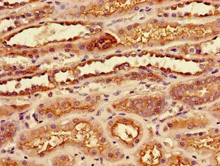 SLC7A7 Antibody