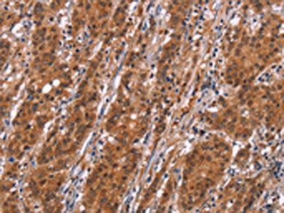SLC8A2 Antibody
