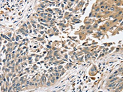 SLC8A3 Antibody