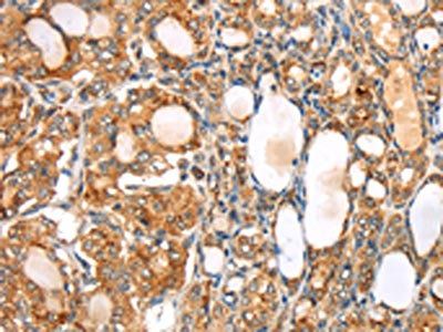 SLC8B1 Antibody