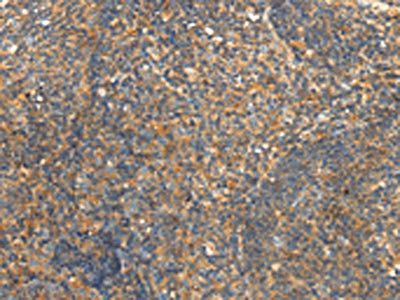 SLC8B1 Antibody