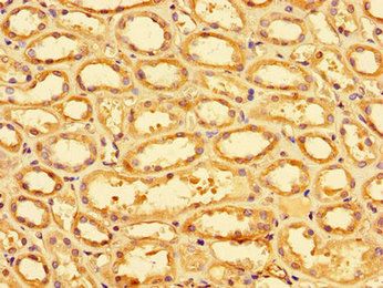 SLC9A1 Antibody