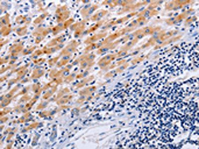 SLC9A3 Antibody