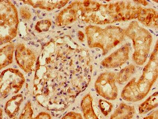 SLC9A3R2 Antibody