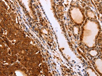 SLC9A3R2 Antibody
