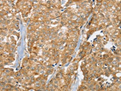SLC9A3R2 Antibody