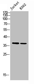 SLC9A3R2 antibody