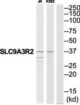 SLC9A3R2 antibody
