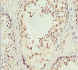 SLC9A6 Antibody