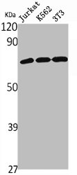 SLC9A9 antibody