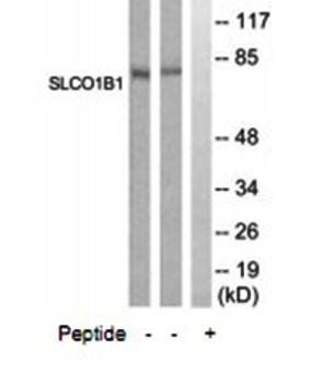 SLCO1B1 antibody