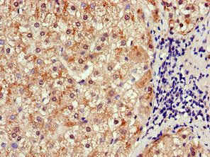SLCO1B3 Antibody