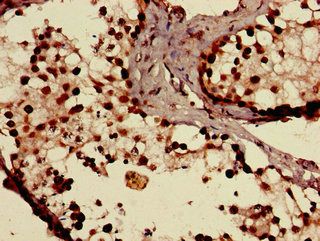 SLCO1C1 antibody