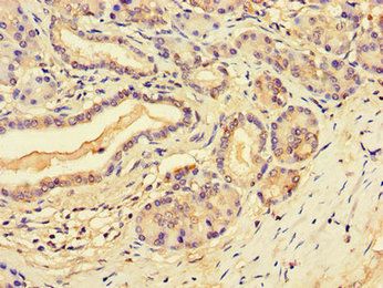 SLFN11 antibody