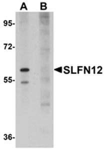 SLFN12 Antibody