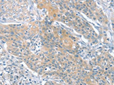 SLIT2 Antibody