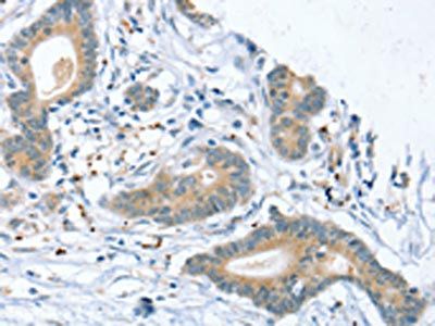 SLIT2 Antibody