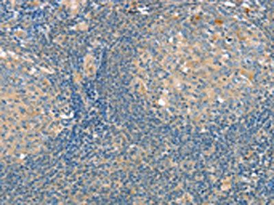 SLIT3 Antibody
