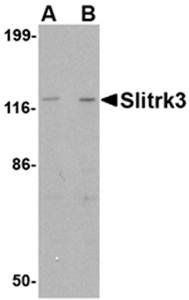 Slitrk3 Antibody