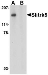 Slitrk5 Antibody