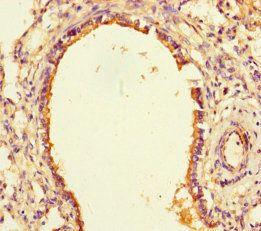 SLITRK6 Antibody