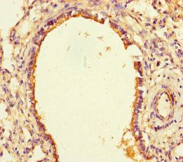 SLITRK6 antibody