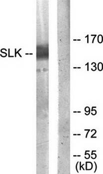 SLK antibody
