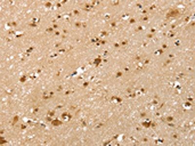 SLTM Antibody