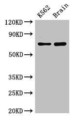 SLU7 antibody