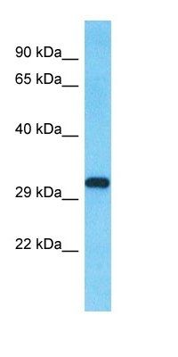 SLX1B antibody