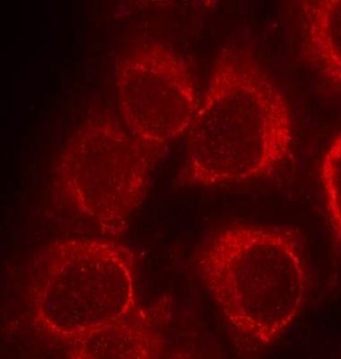 Smad1 (Ab-465) Antibody