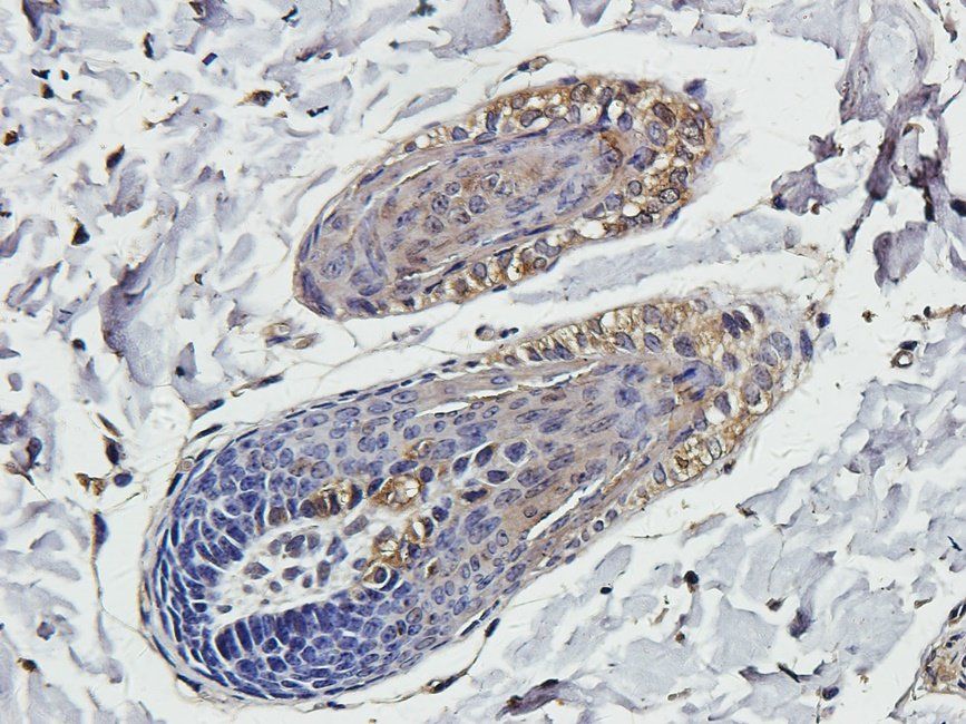 SMAD2 antibody