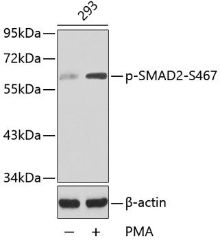 SMAD2 (Phospho-S467) antibody