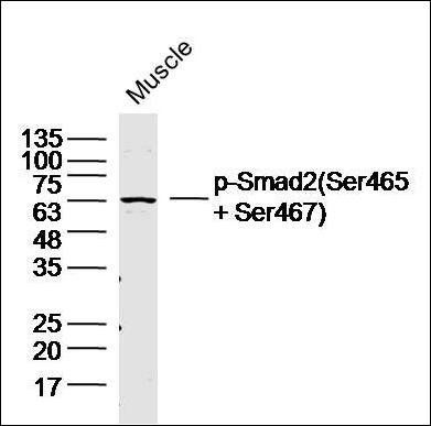 Smad2 (phospho-Ser465/467) antibody