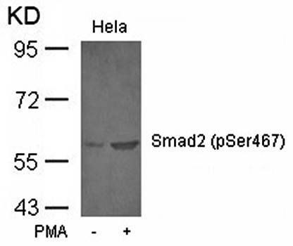 Smad2 (Phospho-Ser467) Antibody