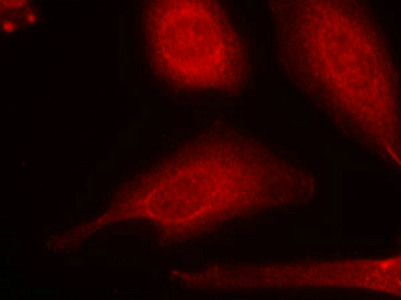 SMAD3 (Ab-425) antibody