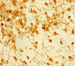 SMAD5 Antibody