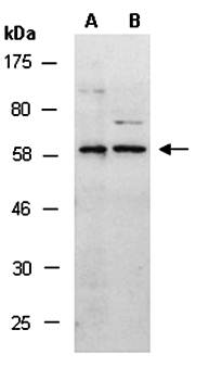 SMAD6 (M) Antibody, Rabbit Polyclonal