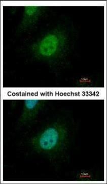 SMAD family member 9 Antibody