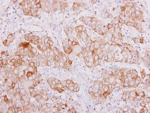 SMAD9 Rabbit Polyclonal Antibody