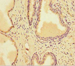 SMARCA1 Antibody