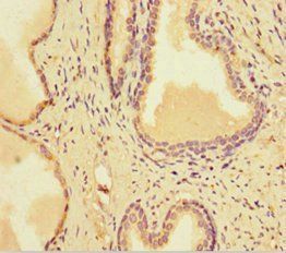 SMARCA1 antibody