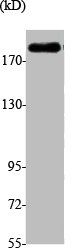 SMARCA2 antibody