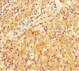 SMARCA4 Antibody