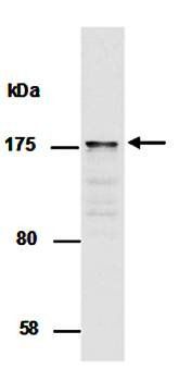 SMARCC2 antibody
