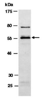SMARCE1 (N) Antibody, Rabbit Polyclonal