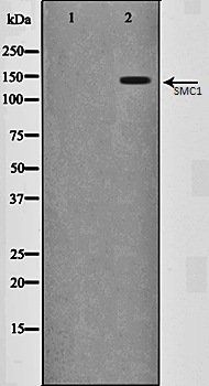SMC1 antibody